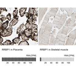 RRBP1 Antibody, Novus Biologicals 25 &mu;L; Unlabeled:Antibodies, Polyclonal